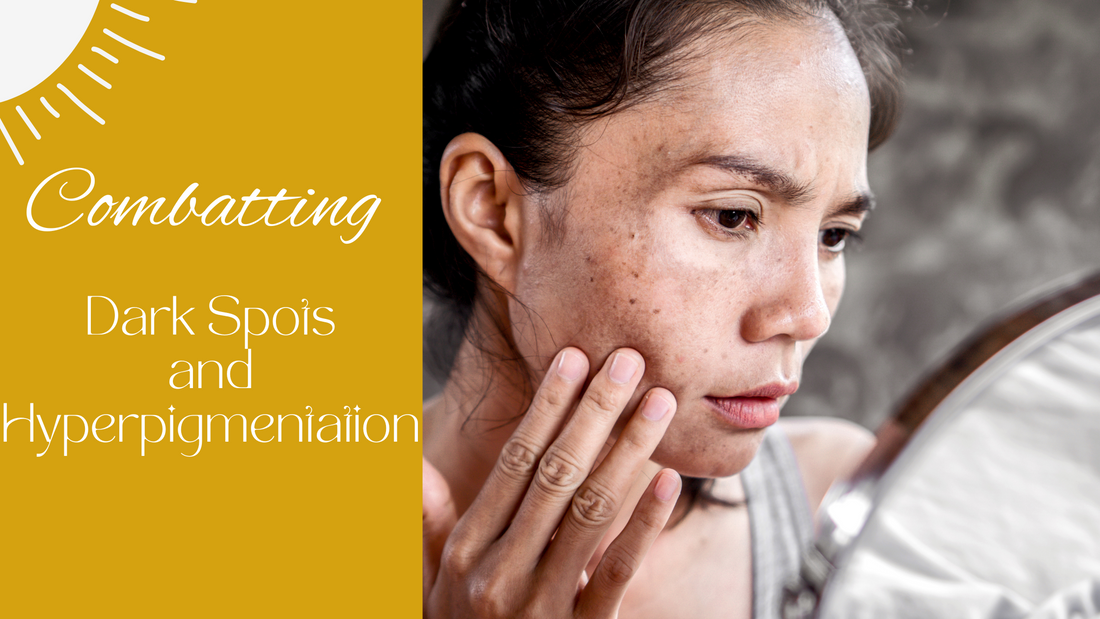 Combatting Dark Spots and Hyperpigmentation
